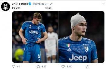 Perban Kepalanya Nyeleneh, De Ligt Jadi Bahan Guyonana Netizen