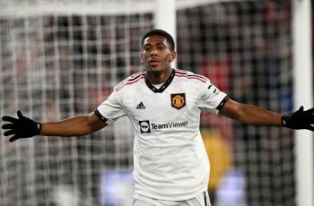 Cedera, Anthony Martial Absen Bela Manchester United Lawan Manchester City